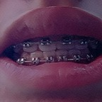 bracesfetish OnlyFans Leak 

 profile picture